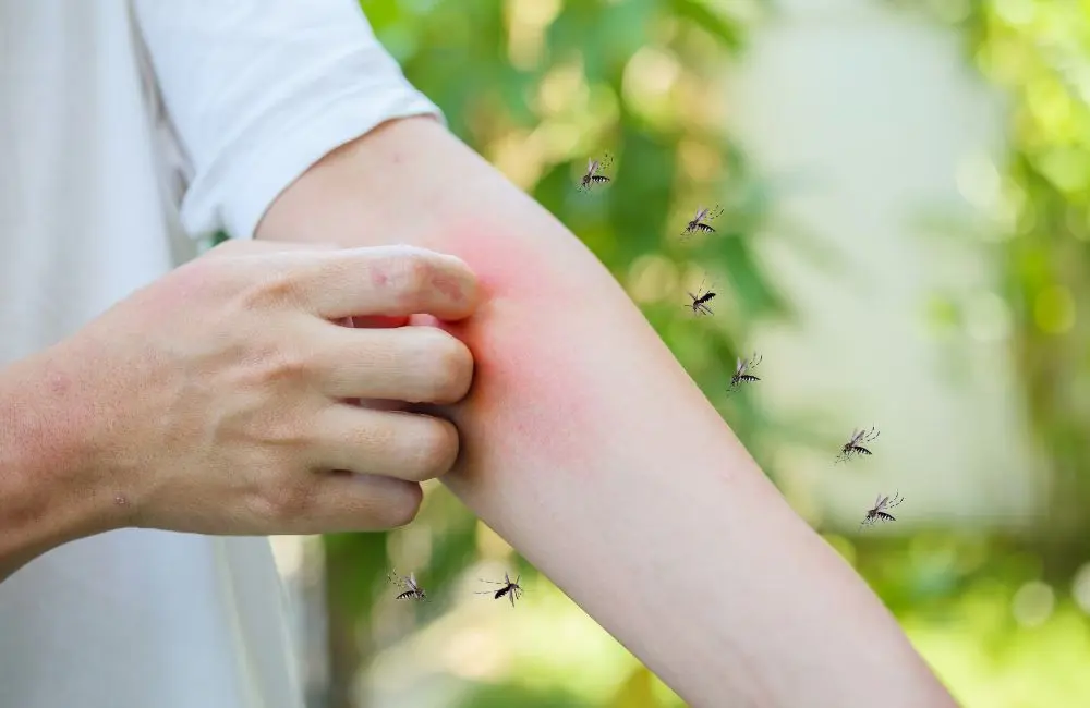 picadura de dengue