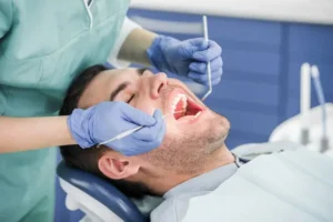 Sarro dental: Cómo afecta tus dientes y cómo prevenirlo