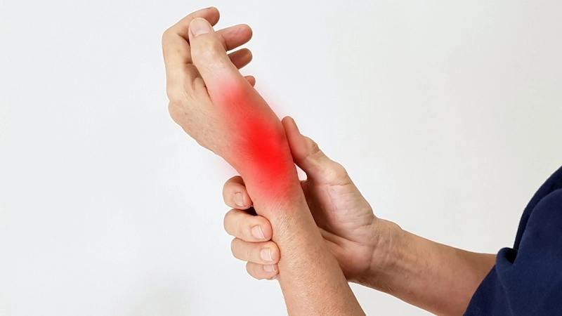 Tendinitis y síndrome del túnel carpiano